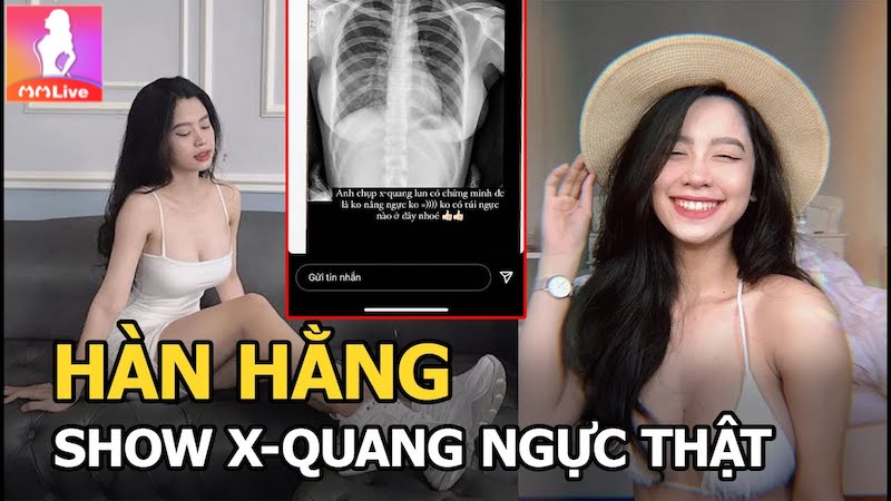 không hề có túi ngực
